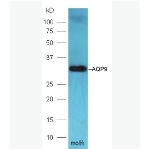 AQP9 水通道蛋白-9抗体