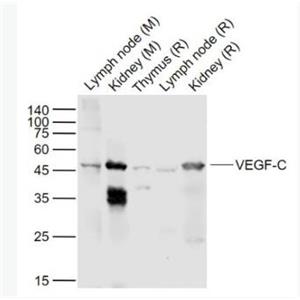 VEGF-C 血管内皮生长因子C型抗体,VEGF-C