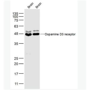 Dopamine D3 receptor 多巴胺受体D3抗体,Dopamine D3 receptor