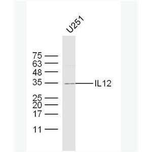 IL12 白介素12抗体,IL12