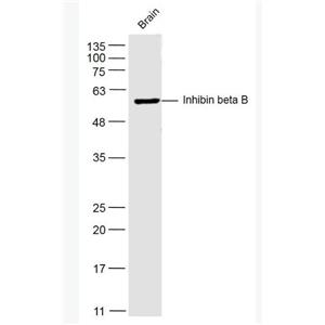 Inhibin beta B 抑制素βB/Inhibin β B抗體