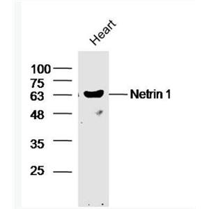  Netrin 1 轴突导向因子1抗体