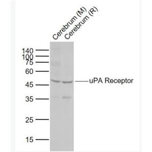 PLAUR 尿激酶型纤溶酶原激活因子受体（CD87）抗体