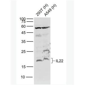 IL-22 白介素-22抗体
