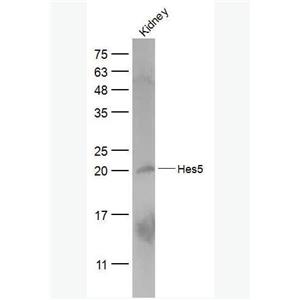 HES5 发状分裂相关增强子-5抗体