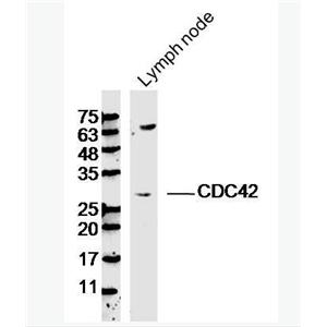 CDC42 细胞分化周期CDC42蛋白抗体