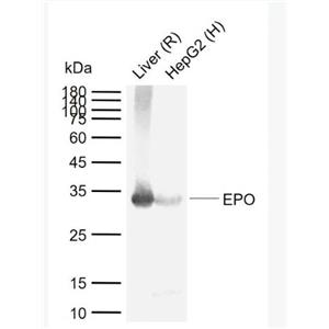 EPO 红细胞生成素抗体,EPO