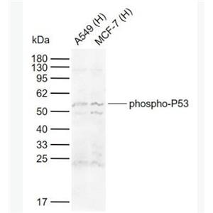 phospho-P53 (Ser15) 磷酸化肿瘤抑制基因P53抗体