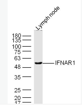 IFNAR1 干扰素α/β受体1抗体,IFNAR1