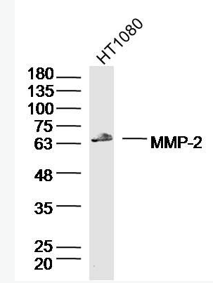 MMP2 基质金属蛋白酶-2抗体,MMP2