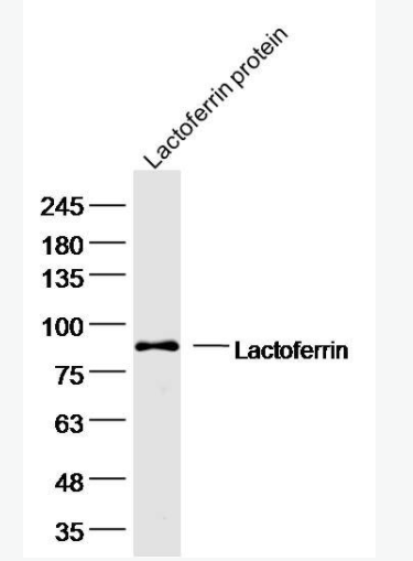 Lactoferrin 乳鐵蛋白抗體,Lactoferrin