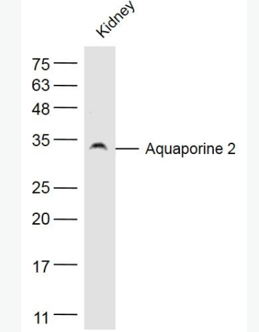 AQP2 水通道蛋白-2抗體,AQP2