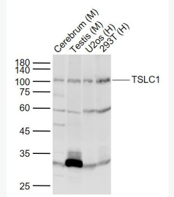 TSLC1 細(xì)胞粘附分子1抗體,TSLC1