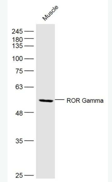 RORC 维甲酸相关孤儿受体γ抗体,RORC