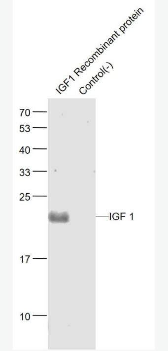 IGF I 胰岛素样生长因子1抗体,IGF I