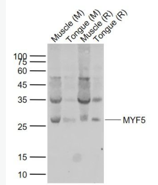 MYF5 生肌决定因子Myf5抗体,MYF5