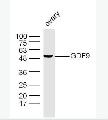 GDF9 生長分化因子9抗體,GDF9