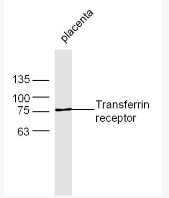TFRC 转铁蛋白受体（CD71）抗体,TFRC