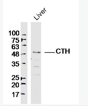 CTH 胱硫醚γ裂解酶抗体,CTH