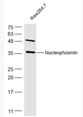 Nucleophosmin 核仁磷酸蛋白抗体,Nucleophosmin