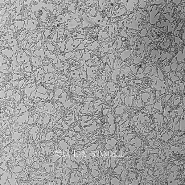人脑星形胶质母细胞瘤细胞,U-87 MG