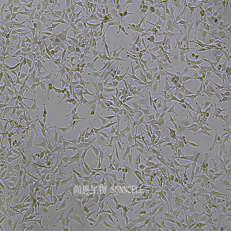 人胶质母细胞瘤细胞,A172
