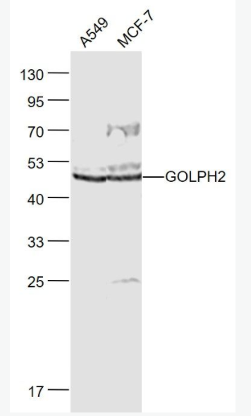 GOLPH2 高爾基體膜蛋白GP73抗體,GOLPH2