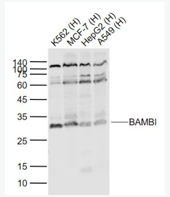 BAMBI 肿瘤转移抑制蛋白BAMBI抗体,BAMBI