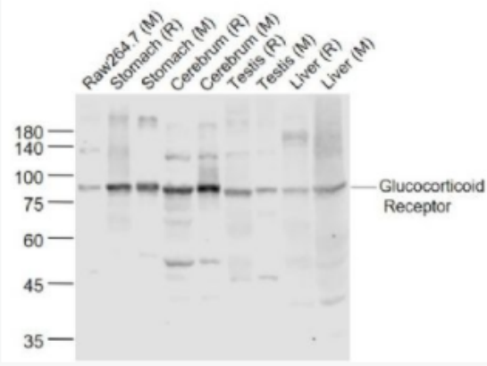 Glucocorticoid Receptor 糖皮质激素受体(β)抗体,Glucocorticoid Receptor