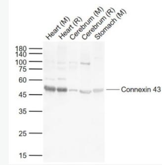 Connexin 43 间隙连接蛋白43抗体,Connexin 43