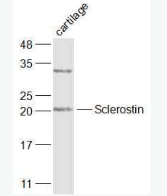 Sclerostin 骨形态发生抑制蛋白SOST抗体,Sclerostin