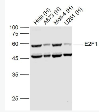 E2F1 转录因子E2F-1抗体,E2F1