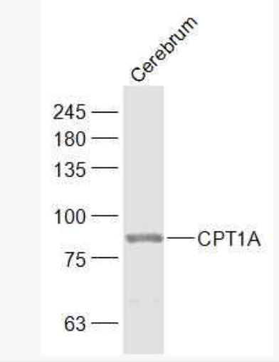 CPT1A 肉毒碱棕榈酰基转移酶1A抗体,CPT1A