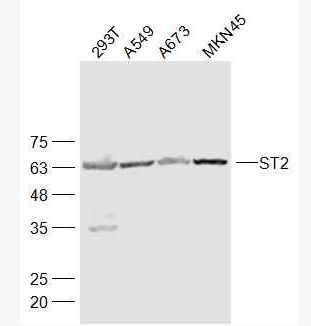 ST2 白細(xì)胞介素1受體相關(guān)蛋白抗體,ST2