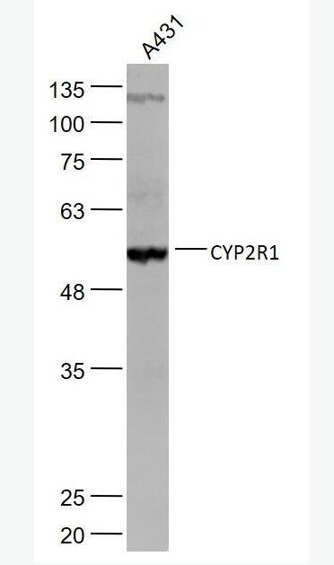 CYP2R1 細(xì)胞色素P450 2R1抗體,CYP2R1