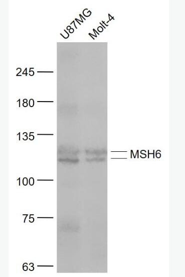 MSH6 錯(cuò)配修復(fù)蛋白6抗體,MSH6