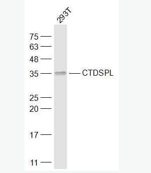 CTDSPL 联会复合体蛋白3抗体,CTDSPL