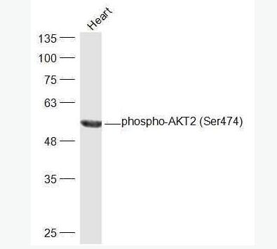 phospho-AKT2 (Ser474) 磷酸化蛋白激酶B2抗体,phospho-AKT2 (Ser474)