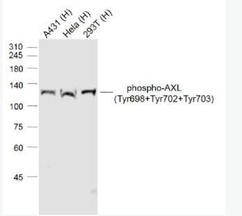 phospho-AXL (Tyr698+Tyr702+Tyr703) 磷酸化粘附相关激酶抗体,phospho-AXL (Tyr698+Tyr702+Tyr703)
