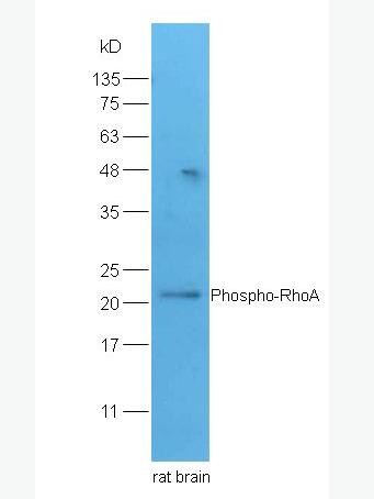 Phospho-RhoA (Ser188) 磷酸化RhoA蛋白抗体,Phospho-RhoA (Ser188)