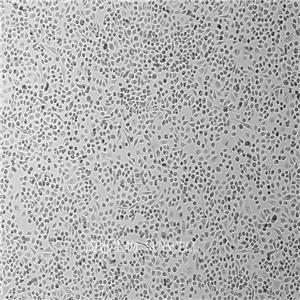 人乳腺管癌细胞,BT-549
