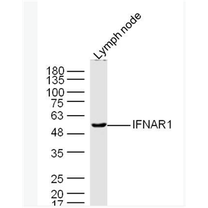 IFNAR1 干扰素α/β受体1抗体