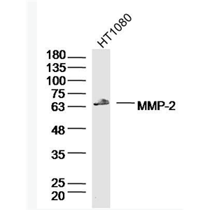 MMP2 基质金属蛋白酶-2抗体