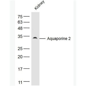 AQP2 水通道蛋白-2抗体