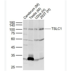 TSLC1 細(xì)胞粘附分子1抗體,TSLC1