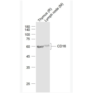 CD16 FC段γ受体3/免疫球蛋白G Fc段受体III抗体