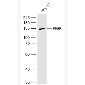 PIGR 多聚免疫球蛋白受体抗体