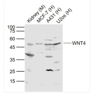 WNT4 信号通路Wnt4抗体,WNT4