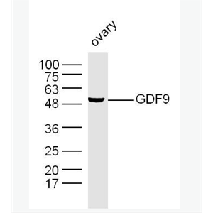 GDF9 生长分化因子9抗体