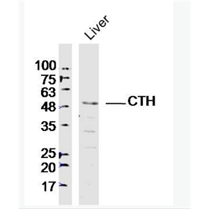 CTH 胱硫醚γ裂解酶抗体